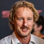 Owen Wilson Nase